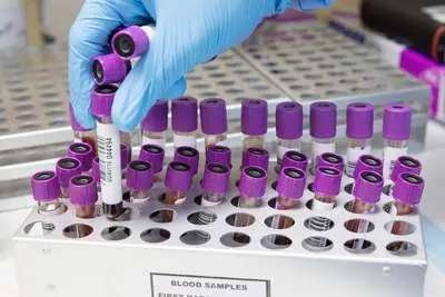 Blood collection tubes for pet wellness bloodwork