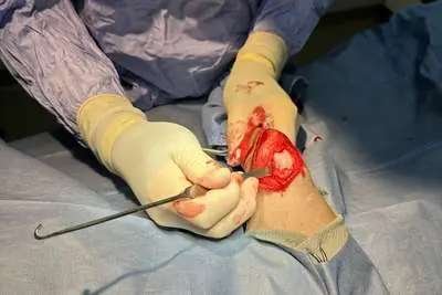Veterinary orthopedic surgery in progress