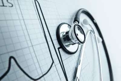 Stethoscope resting on an ECG printout